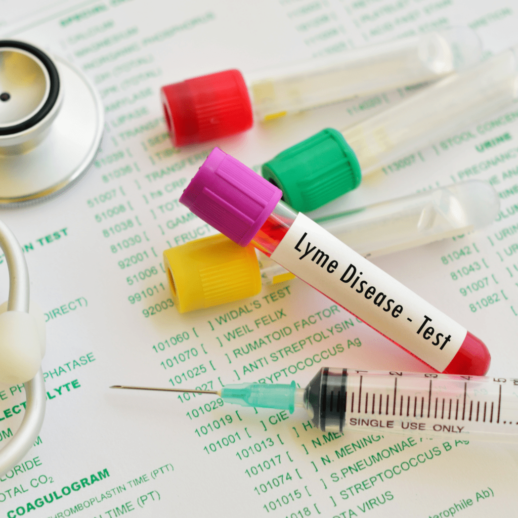 Lyme disease overview complexity diagnosis more