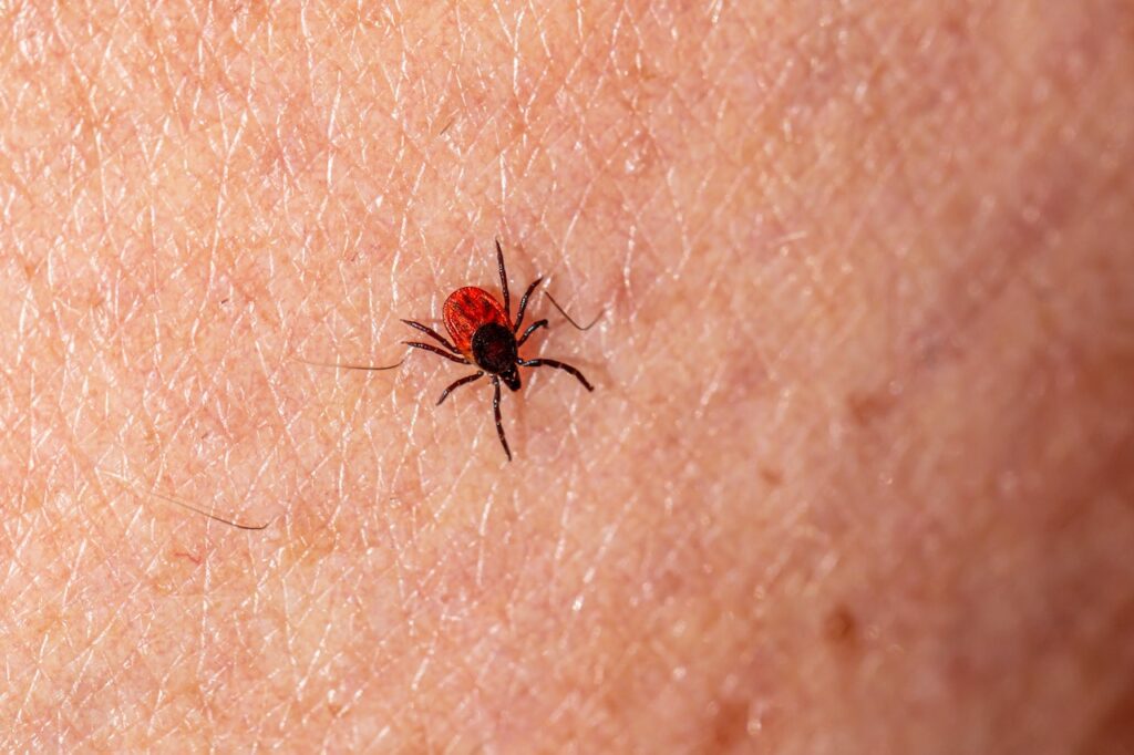 Lyme Disease Symptoms in Humans