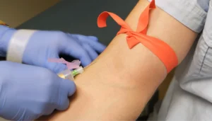 lyme disease blood test name