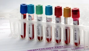 lab tests for tick-borne diseases