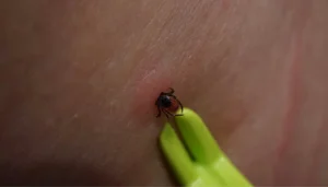 tick bite symptoms