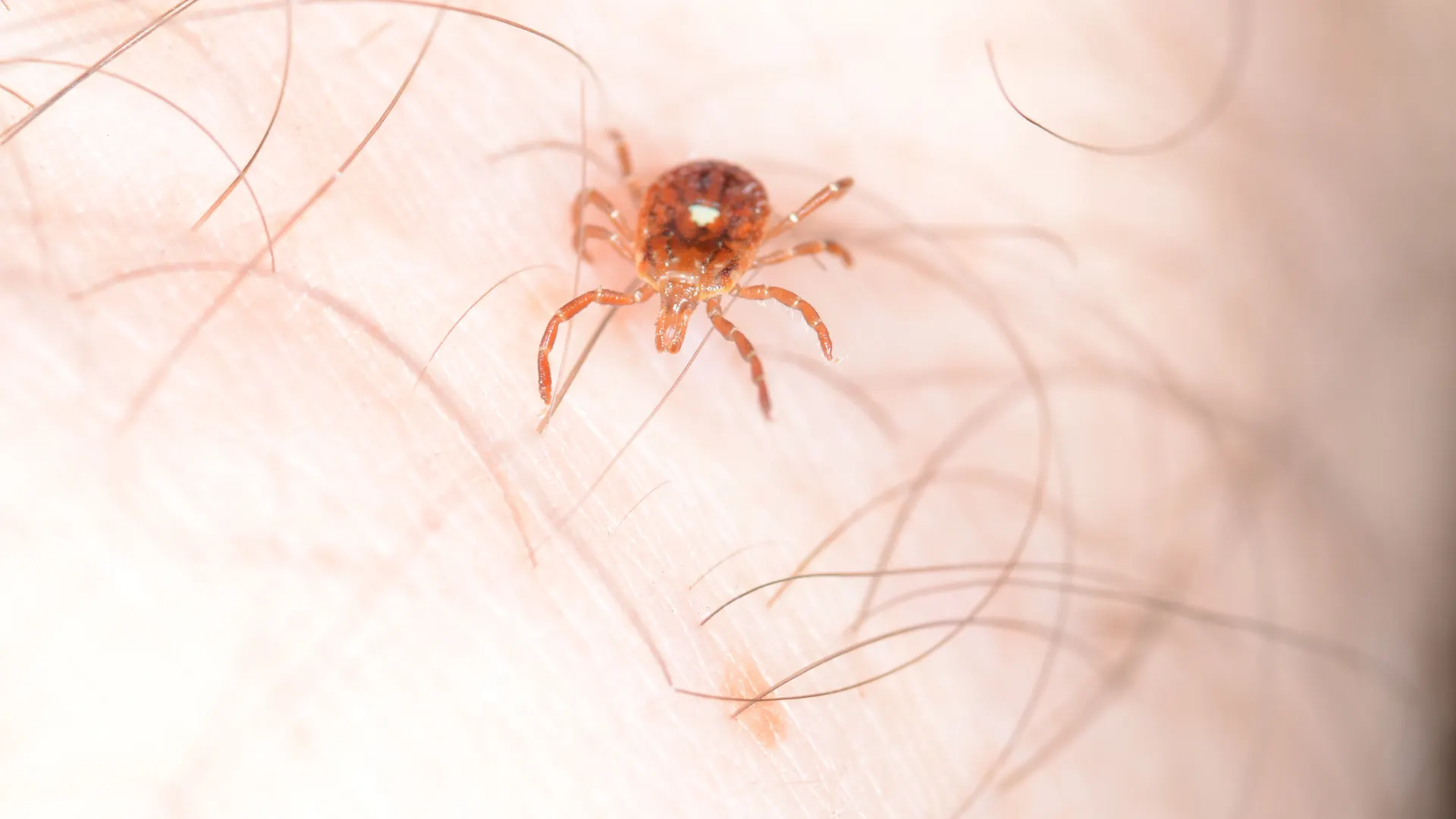 Lyme disease doctor Alabama
