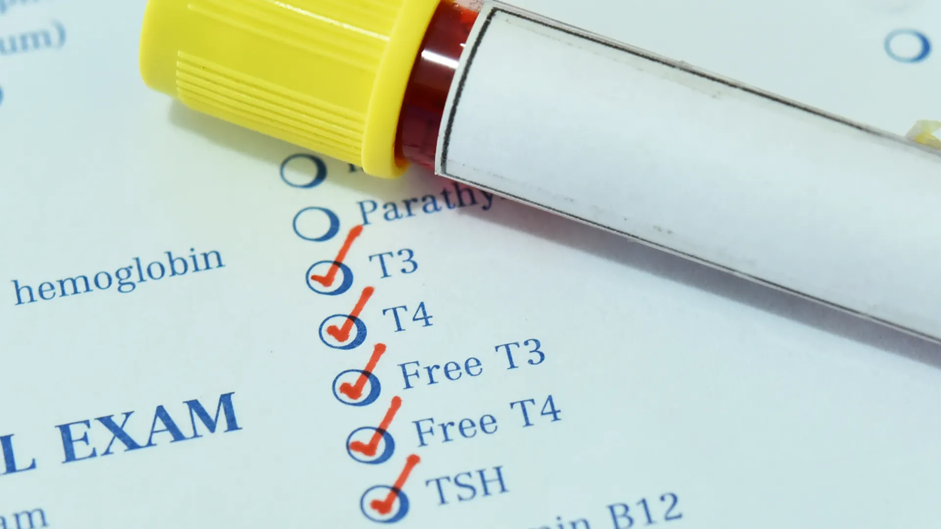blood draw tube for thyroid panel test
