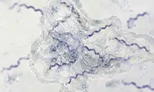 Microscope view of clustered spiral bacteria inside a translucent sticky matrix