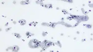 Illustration of red blood cells with small ring-shaped Babesia parasites inside