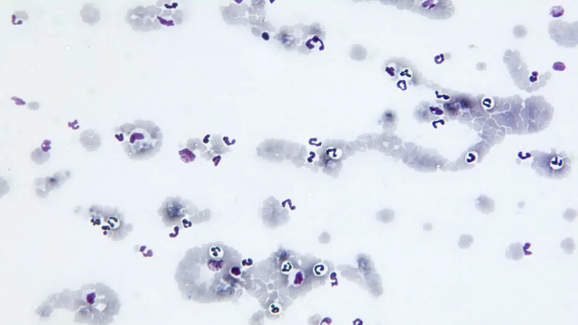 Illustration of red blood cells with small ring-shaped Babesia duncani parasites inside